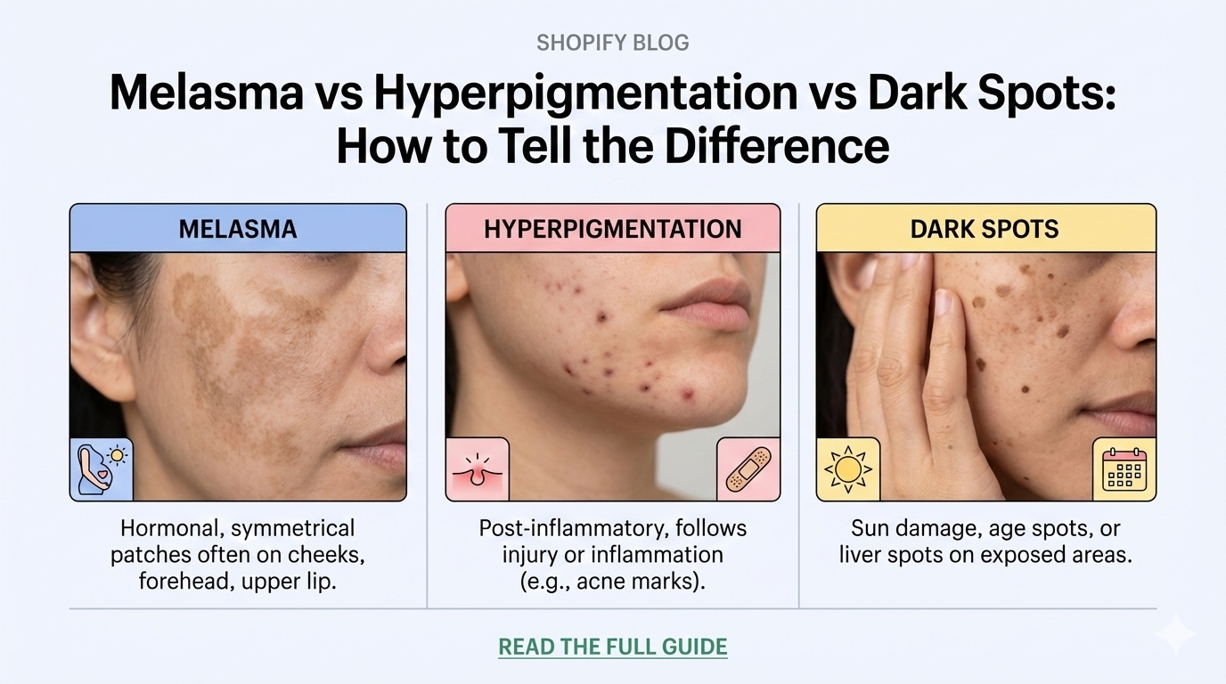 Melasma vs Hyperpigmentation vs Dark Spots: How to Tell the Difference