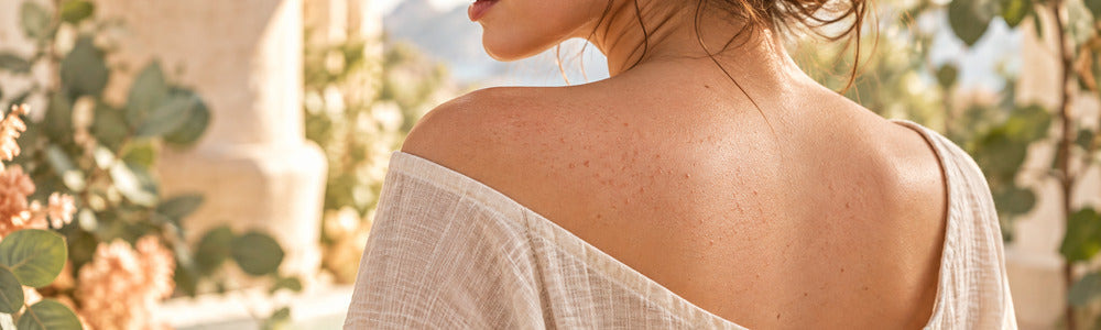 Woman with subtle uniform follicular bumps across the upper back
