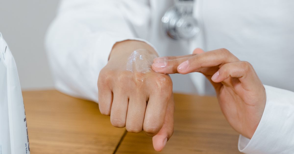 Best Wet Wraps for Eczema: Soothe Severe Flares Fast