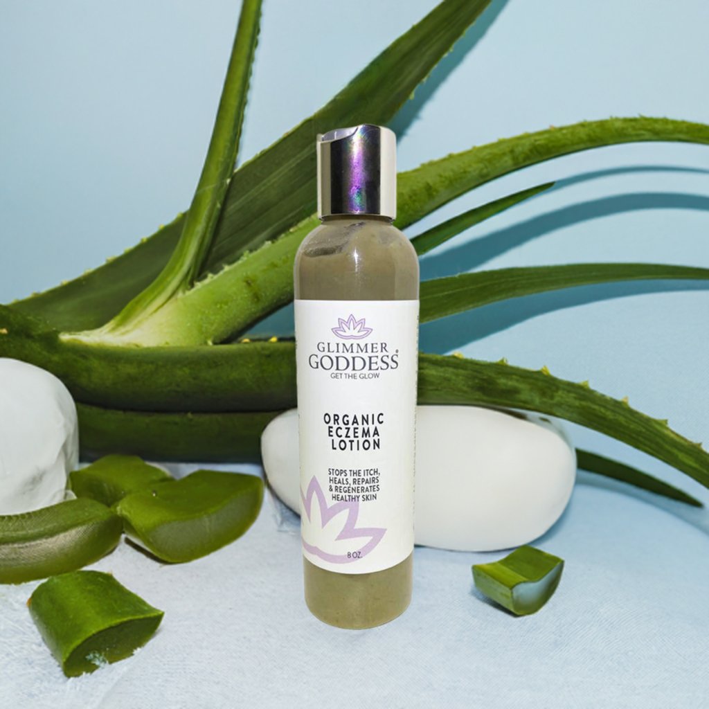Aloe Vera next to Organic Eczema Lotion from Glimmer Goddess
