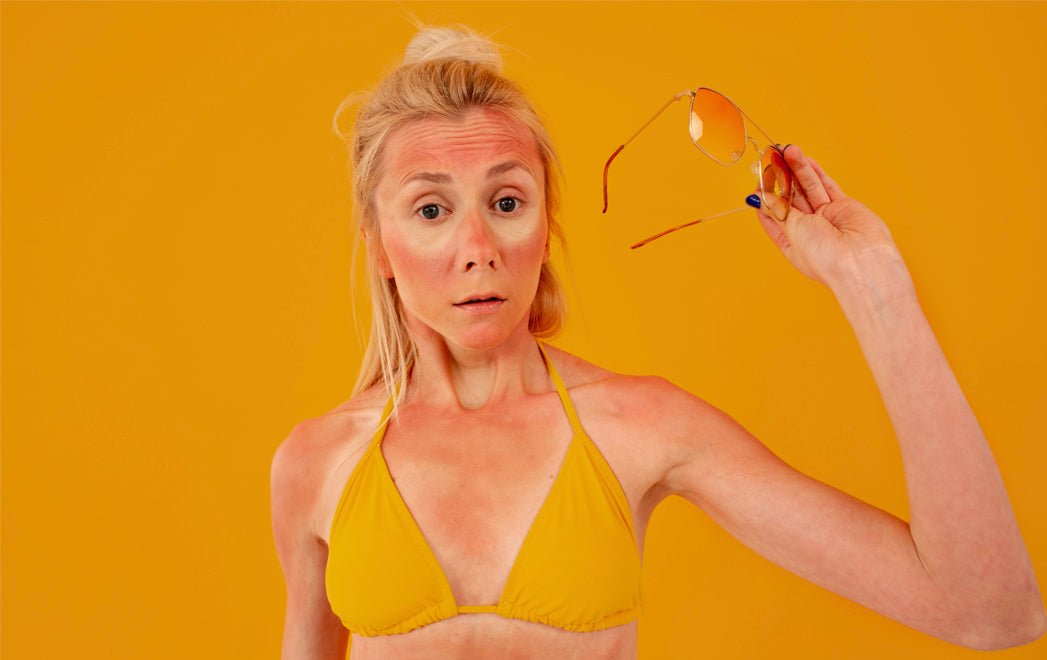 5 Natural Ways to Treat Sun Damage: A Comprehensive Guide - Glimmer Goddess® Organic Skin Care