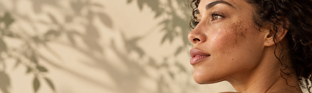 Woman with natural uneven pigmentation in soft botanical light