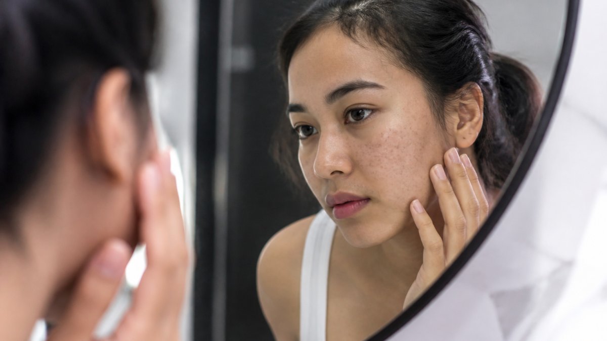 Black Spots on Face: Causes, Dark Spots & Gentle Care