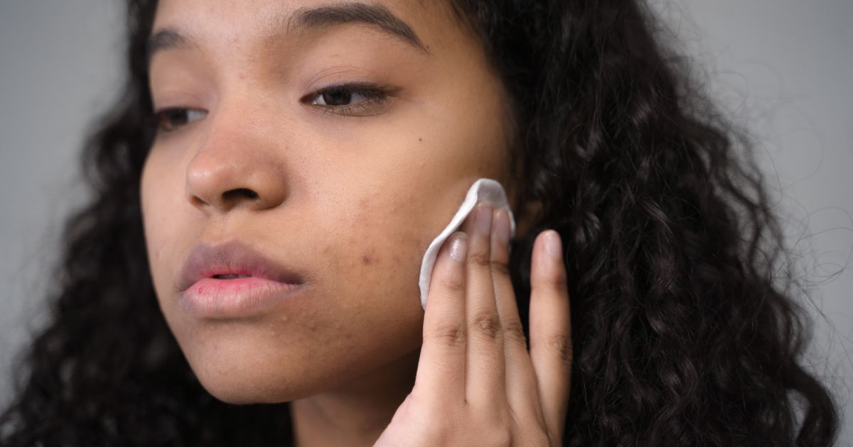 Best Dark Spot Remover 2026: Top 5 Ranked
