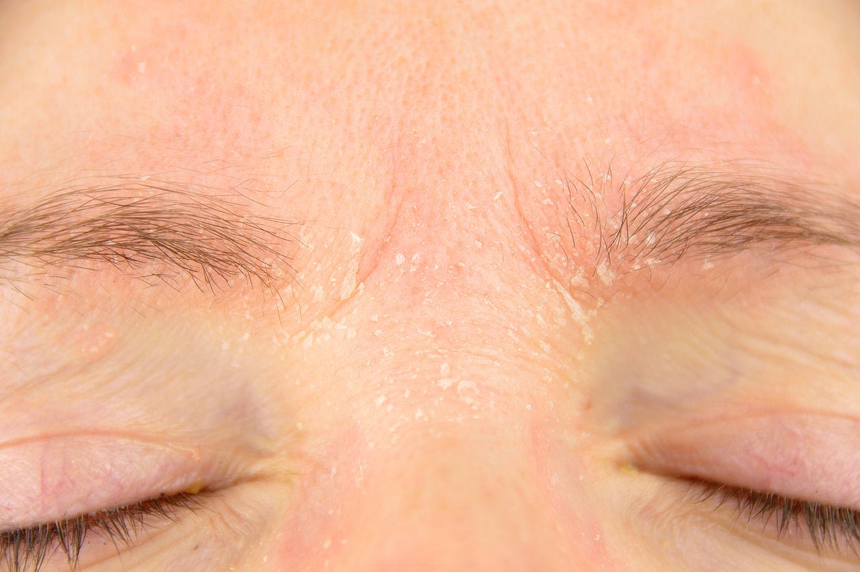 What Is retinol redness? Helpful tips for the retinization process - Glimmer Goddess® Organic Skin Care